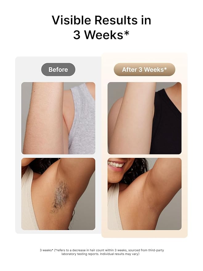 Ulike Laser Hair Removal for Women and Men, Air 3 Ice-Cooling IPL Hair Removal Device for Nearly Painless & Long-Lasting Results, 3 Modes & Auto Flashing for Fast Full Body Hair Removal from Home