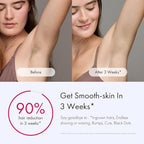 Ulike Laser Hair Removal for Women and Men, Air 3 Ice-Cooling IPL Hair Removal Device for Nearly Painless & Long-Lasting Results, 3 Modes & Auto Flashing for Fast Full Body Hair Removal from Home
